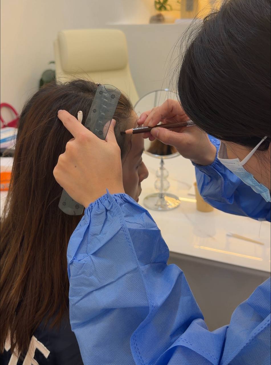 FUE hair transplant procedure in Shanghai