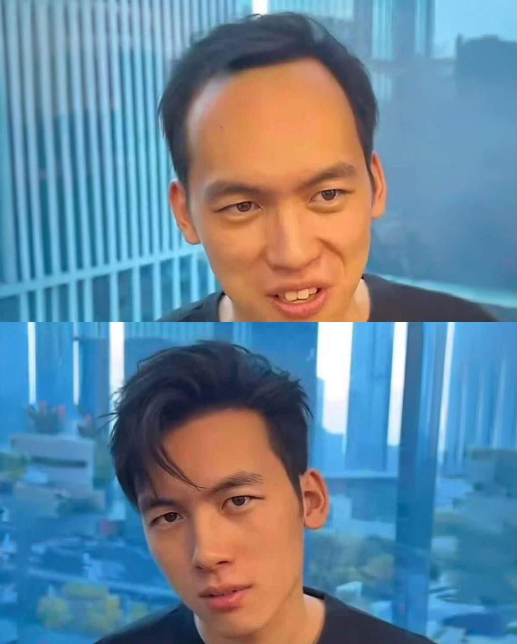 Hair restoration before after Vday concierge